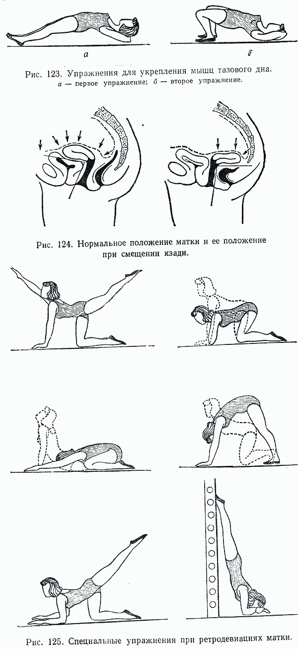 Упражнения при опущении матки для пожилого возраста описание и картинки