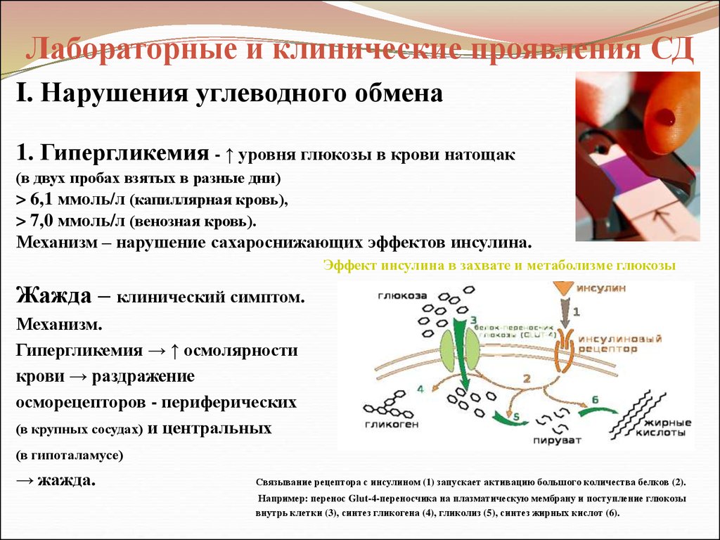 Нарушение углеводного обмена картинки