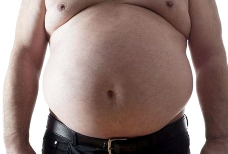 Почему откладывается жир на боках у мужчин заболевания, она также