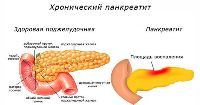 Как принимать льняное масло в лечебных целях, для похудения, при запорах. До или после еды, противопоказания