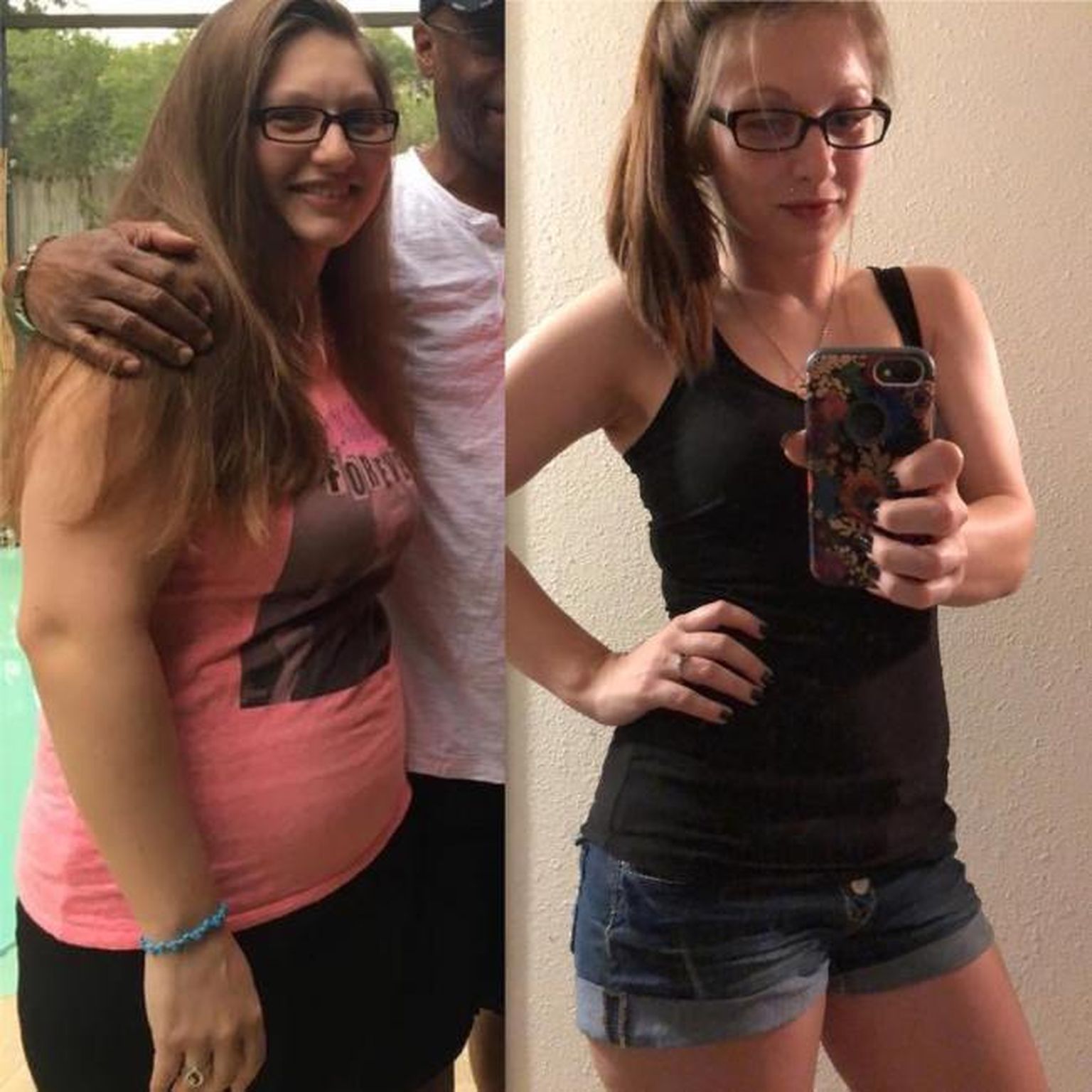 До и после похудения подростки