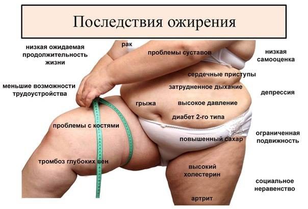 Болезни провоцируемые ожирением