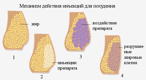 Механизм действия инъекций для похудения