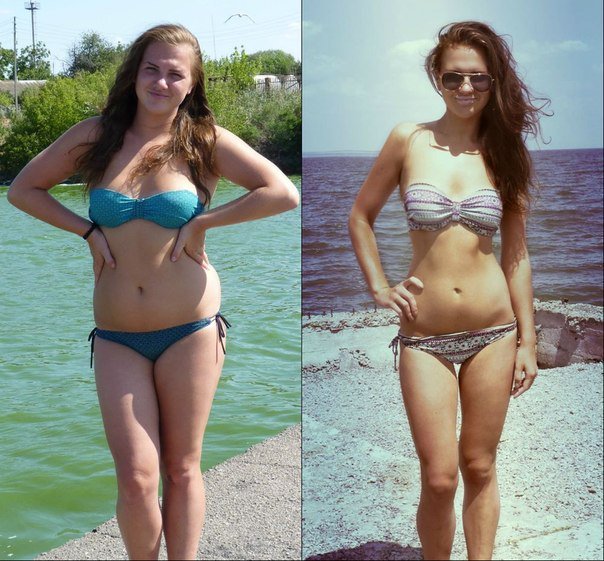 Похудела на 30 кг фото до и после в купальнике