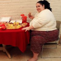 ожирение третьей степени морбидное