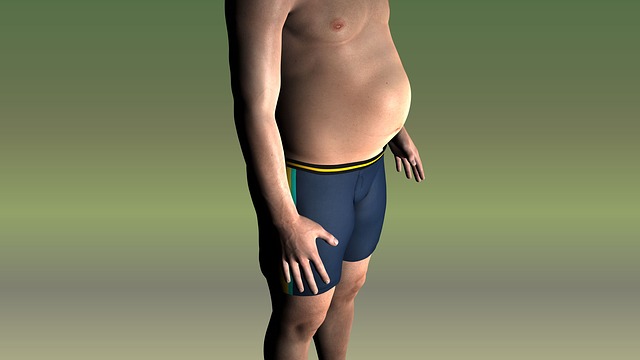 Абдоминальное ожирение: что это такое и как избавиться от проблемы